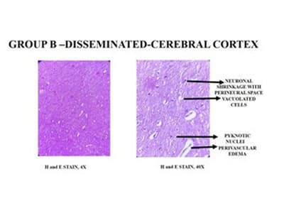 Neuroprotective Effect of Chloroform Fraction of Pterocarpus marsupium Roxb Bark and its Isolated Compound (Afzelechin)