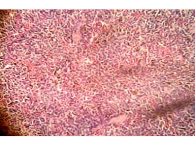 Acute Toxicity Study of Novel Ayurvedic Formulation Siddha Shalmali Kalpa (Classical Shalmali malabarica formulation) in Wistar Rat in vivo Experimental Study