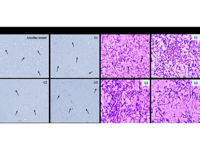 Theaflavin Attenuates Arecoline-induced M1 Polarization and Promotes Homeostasis in Human Periodontal Ligament Fibroblasts