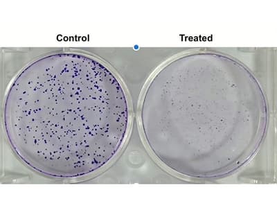 Anticancer Potential of Tephrosia maxima: Inhibition of Cell Viability and Colony Forming Ability in Oral Squamous Cell Carcinoma Cell Lines