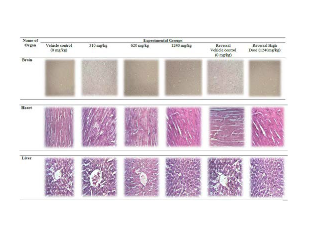 Histopathology of female organs.