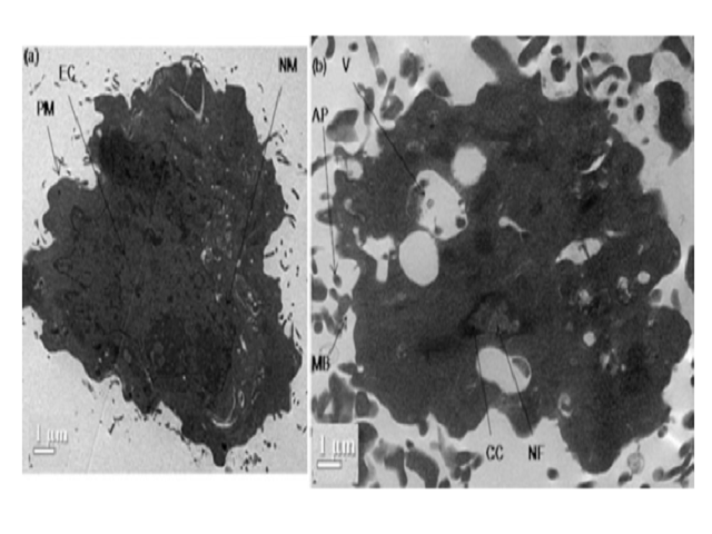 TEM micrographs showing (a) untreated cell showing intact plasma membrane (PM), evenly distributed chromatin (EC), intact nuclear membrane (NM), (b) NGN treated cell showing nuclear fragmentation (NF), chromatin condensation (CC), vesicle formation (V), membrane blebbing (MB) and apoptotic bodies (AP).