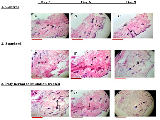 Histology photographs of excision wound model collected from different groups of rats on different days. (Magnification 10×) A) Control, B) Standard (framycetin), C) Poly herbal gel (PHG) treated (scale 100.0 pixel) α –sebaceous gland; β- epidermis; ©- granulated tissue; # -collagen.