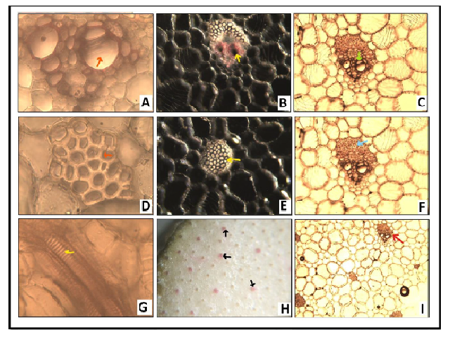 Transverse section of Sansevieria cylindrica leaves shows A: Metaxylem (X 400)