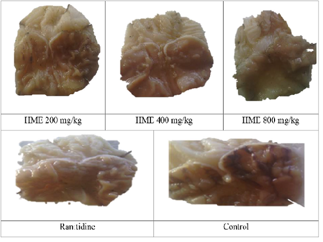 Effect of H. madagascariensis leaf extract on ethanol-induced gastric ulcer in rats