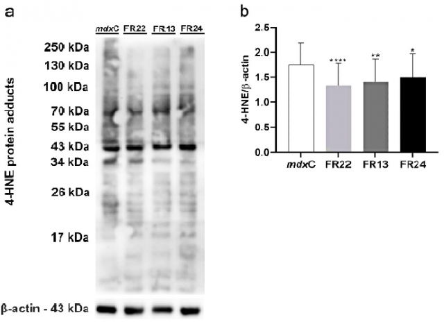 Western blotting analysis of 4-HNE protein adducts (A) in muscle cells from mdxC (dystrophic untreated cells) and treated at different fractions