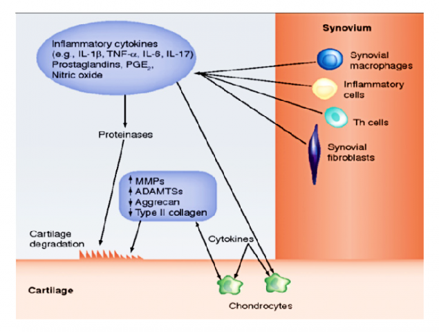 Pathophysiology of OA