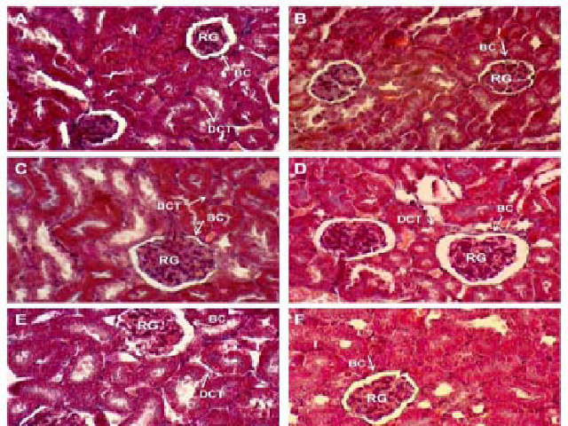 Effect of the administration of the hydroalcoholic extract of Echeveria subrigida (HE-Es) (1000 mg/kg of b.w./day)