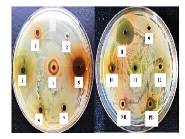 Screening of antifungal activity by different plants. Zone of antifungal inhibition of leaves or seed methanol extract of various plants (numbering as per Table 1) on T. rubrum, PB-Positive control,