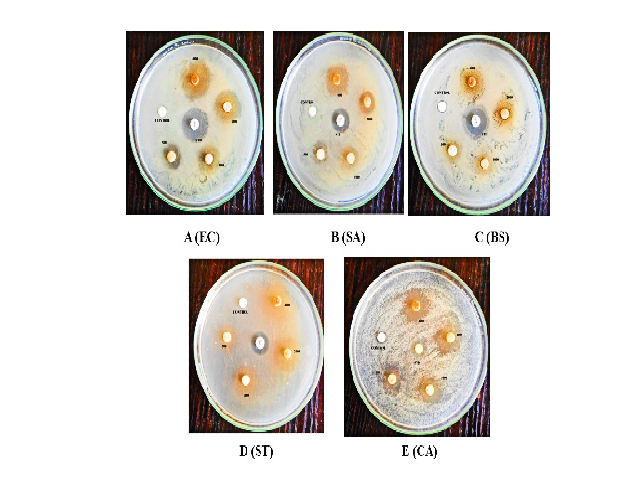 Illustration of culture plates representing anti-microbial efficacy of the test drug PKC.