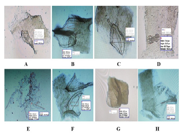 Quantitative microscopy of hymenium of fruiting body A. Clavate, 4-sterigmate basidium, B. Sphaeropedunculate, C. lanceolate thick-walled, D. utriform, E. Aciculate, F. Mucronate, G. Cornuate (Antlered), H. Subcapitate.