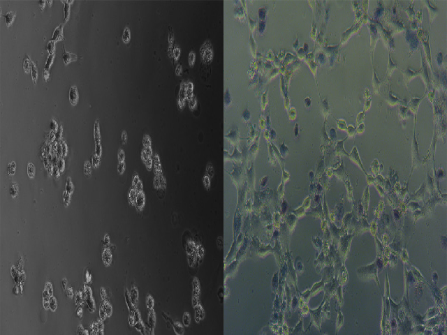 Cell photograph after 6 hr of incubation. Left: internal control with no treatment, Right: treated with 50 μg/mL of CPH ethanolic extract.