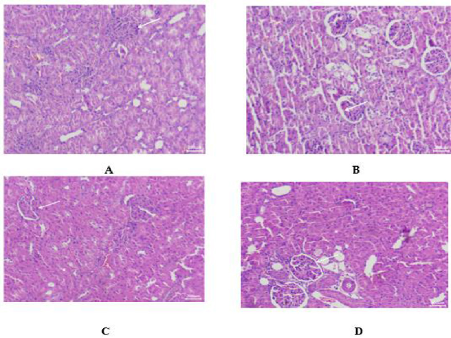 Histopathological variations of kidneys under the effect of Ecklonia cava polyphenols alongside KBrO3.