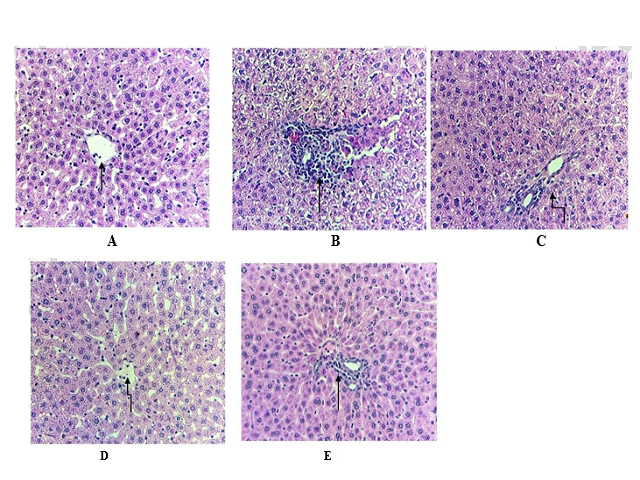 Effect of Calx of Copper against antitubercular drugs (INH, RIF, and PYZ) induced histopathological alteration in experimental groups of rats (H&E staining @ 40X). (A) Normal control, (B) positive control anti- tubercular drugs (INH, RIF, and PYZ) induced rat liver damage, (C and D) Histological Examination of Hepatic Tissue in Rats Administered with Copper Calx at Doses of 6.17 mg/kg and 12.33 mg/kg, (E) Histological Analysis of Hepatic Tissue in Silymarin-Treated Rats.