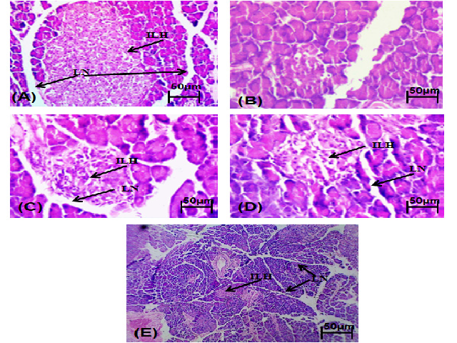 Effect of Insuwin and Insuwin forte on pancreas histopathological changes in diabetic rats. Effect of Insuwin and Insuwin forte on pancreas