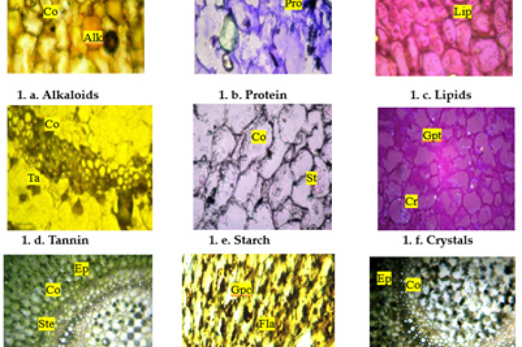 Histochemical localization of secondary metabolites in Ceropegia juncea Roxb. Stem.