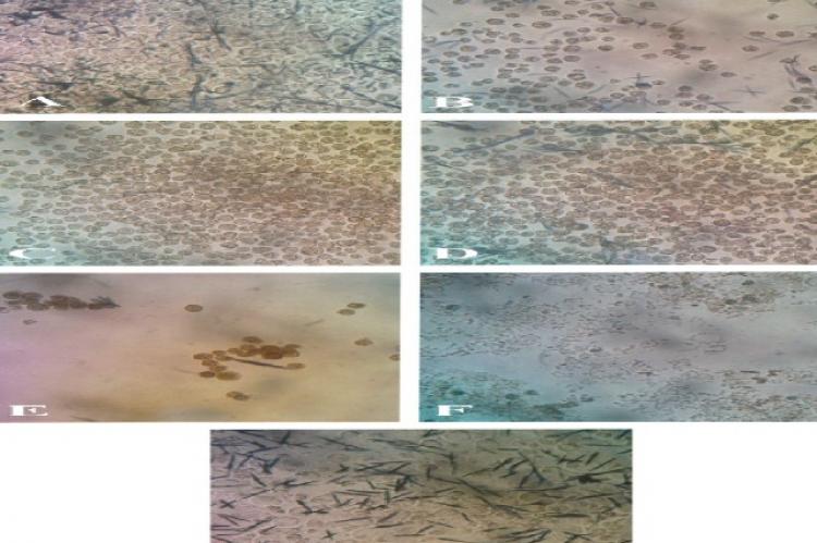 Morphology of Jurkat Leukemia Cells after 72 h Treating with Various Concentrations of Leaf Extract of L. camara. A: Solvent control, B: 15.6, C: 62.5, D: 250 and E: 500 μg/ml; F: Triton 100X 1%, G: Negative Control. Density of formazan crystals (blue color stick-like objects) is nearly straight linked to cell viability. Magnification is 400×.