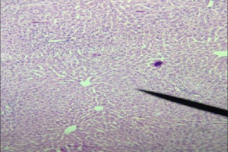 Control group: Normal architecture of hepatic lobules in the form of hepatocytes is maintained and central vein is normal (×40)