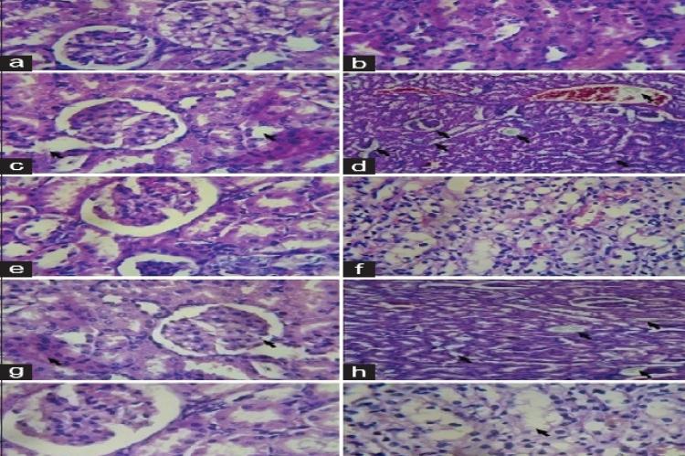 Light microscopic histology and calcium oxalate deposits in the section of kidney. Left side showing kidney section of glomerular region and right side showing tubular region. (a and b) Normal control rat. (c and d) Ethylene‑glycol‑induced urolithiasis rat. (e and f) Cystone‑treated rat. (g and h) Ethanol extract of Biophytum sensitivum (250 mg/kg)‑treated rat. (i and j) Ethanol extract of Biophytum sensitivum (500 mg/kg)‑treated rat (40× for all images)