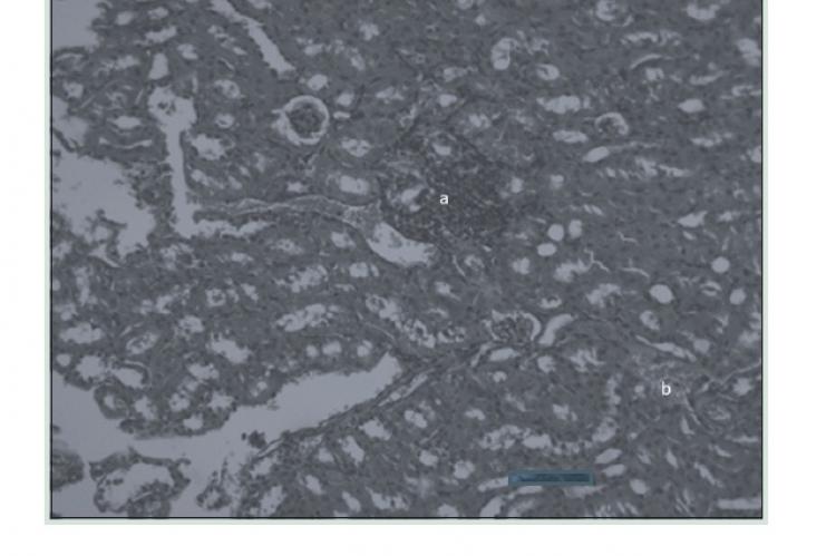 Kidney section of mice treated with oral pulegone (2 g/kg) showing (a) inflammatory infiltrate cells and (b) hemorrhages (H and E, ×100)