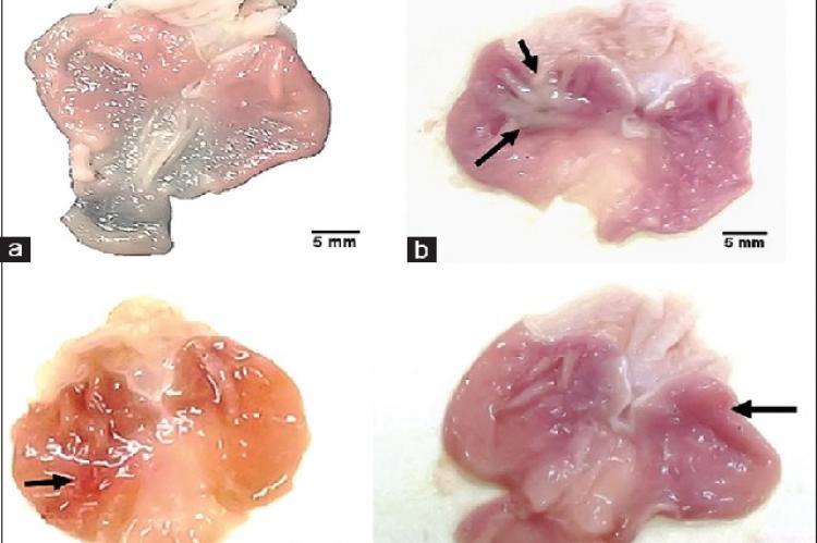 Effect of Geraniol and Clarithromycin Combination against Gastric Ulcers Induced by Acetic Acid and Helicobacter pylori in Rats