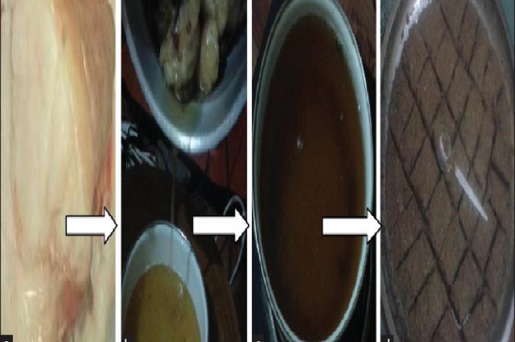 Antilipidemic Properties of Calpurnia aurea Leaf Extract on High-Fat Diet Induced Hyperlipidemia