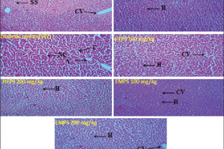 H and E‑stained histopathological sections of liver after 5 weeks of treatment. CV = Central vein, SS = Sinusoids space, H = Hepatocyte, C = Congestion, NC = Necrotic Change, V = Vacuolization