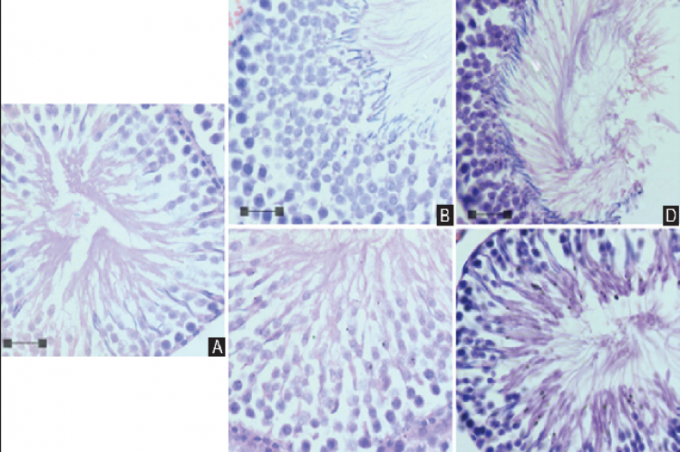 Effects of Newtonia hildebrandtii extracts on Wistar rats' seminiferous architecture.