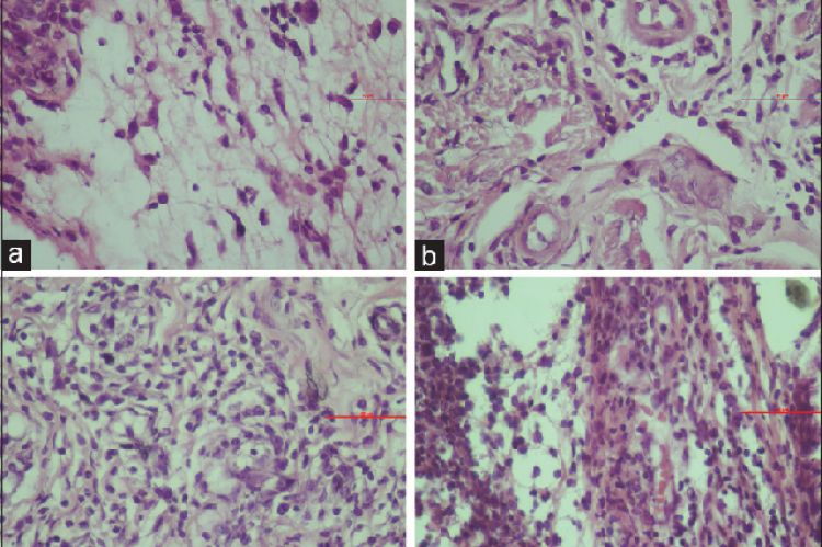 Histological illustration of lymphocytes on the inferior labial mucosa (a) Group A, (b) Group C, (c) Group B, and (d) Group D