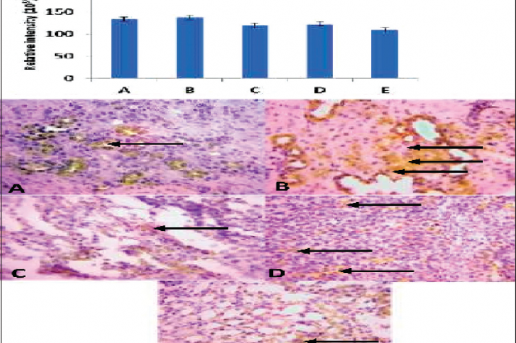 Renal caspase 3 activity