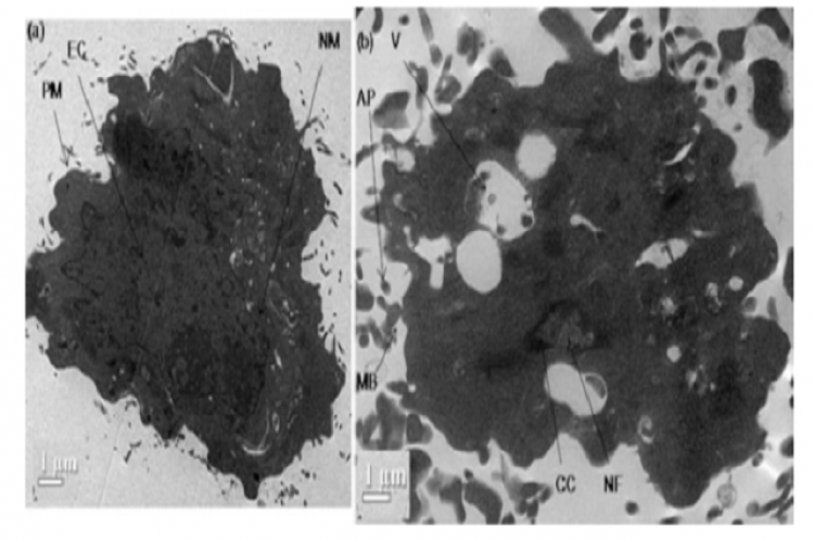 TEM micrographs showing (a) untreated cell showing intact plasma membrane (PM), evenly distributed chromatin (EC), intact nuclear membrane (NM), (b) NGN treated cell showing nuclear fragmentation (NF), chromatin condensation (CC), vesicle formation (V), membrane blebbing (MB) and apoptotic bodies (AP).