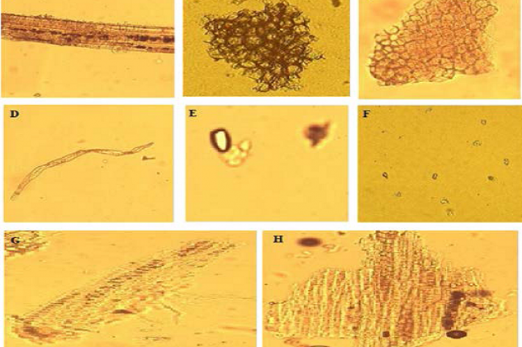 A: Lignified vascular bundles, B: Cork cells, C: Collenchymatus cells, D: Fibrous sclereids, E: Oil cells, F: Prismatic calcium oxalate crystals, G and H: Crystal fibers.