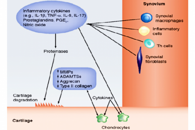 Pathophysiology of OA