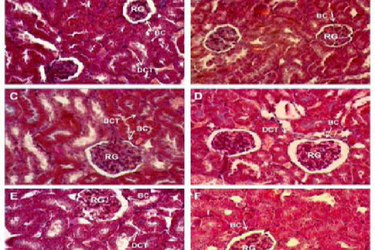 Effect of the administration of the hydroalcoholic extract of Echeveria subrigida (HE-Es) (1000 mg/kg of b.w./day)