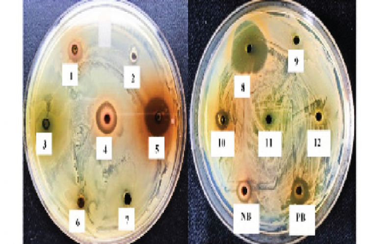 Screening of antifungal activity by different plants. Zone of antifungal inhibition of leaves or seed methanol extract of various plants (numbering as per Table 1) on T. rubrum, PB-Positive control,