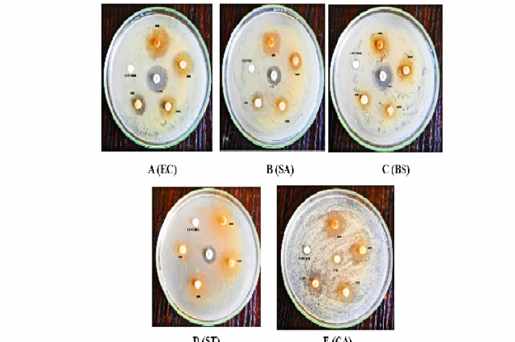 Illustration of culture plates representing anti-microbial efficacy of the test drug PKC.