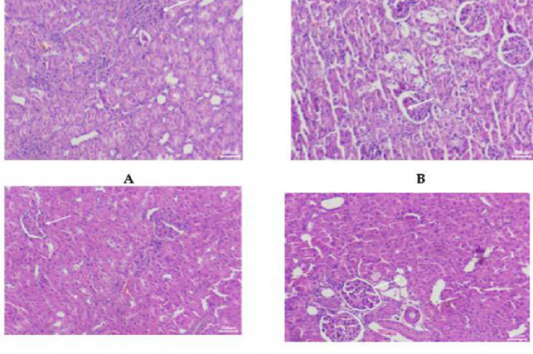 Histopathological variations of kidneys under the effect of Ecklonia cava polyphenols alongside KBrO3.