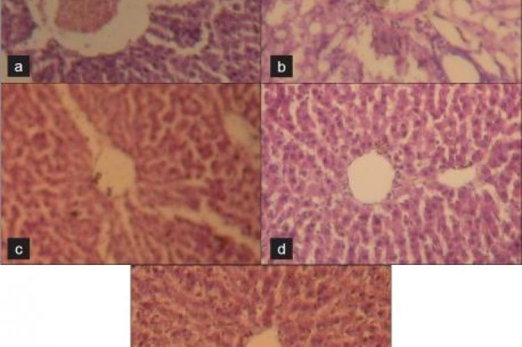 Hepatoprotective activity of Ocimum sanctum alcoholic leaf extract against paracetamol-induced liver damage in Albino rats