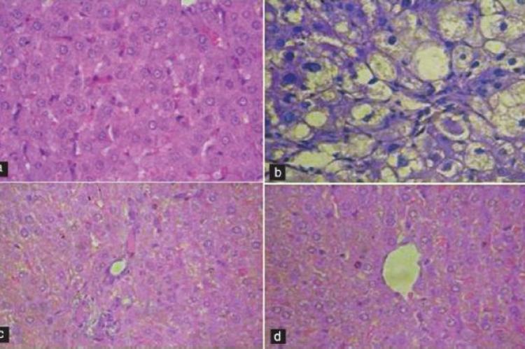 Evaluation of acute toxicity and hepatoprotective activity of the methanolic extract of Dichrostachys cinerea (Wight and Arn.) leaves