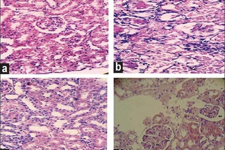 Amelioration of nitrobenzene-induced nephrotoxicity by the ethanol extract of the herb Euphorbia hirta