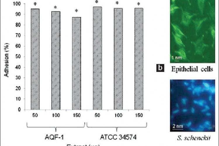 Adhesion of Sporothrix schenckii to epthelial cells (a). Influence of extracts of Flammulina velutipes on the process of adhesion of Sporothrix schenckii yeast cells (c) to epithelial cells (b), shown the inhibition of adhesion at 1 h. The inhibition of adhesion indicates the efficacy of both extracts of Flammulina velutipes. All experiments were performed independently at least 3 times for triplicate. Significance was analyzed using Mann‑Whitney test. Difference was considered significant *p < 0.05