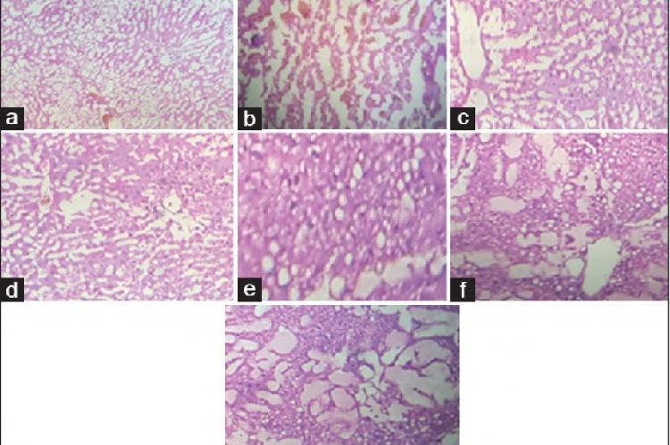 Histopathological representation of liver in carbon tetrachloride induced liver injury in rat treated with various formulations (H and E stain, ×40) (a) Normal, (b) carbon tetrachloride, (c) silymarin, (d) marketed formulation, (e) formulation low dose, (f ) formulation medium dose, (g) formulation high dose