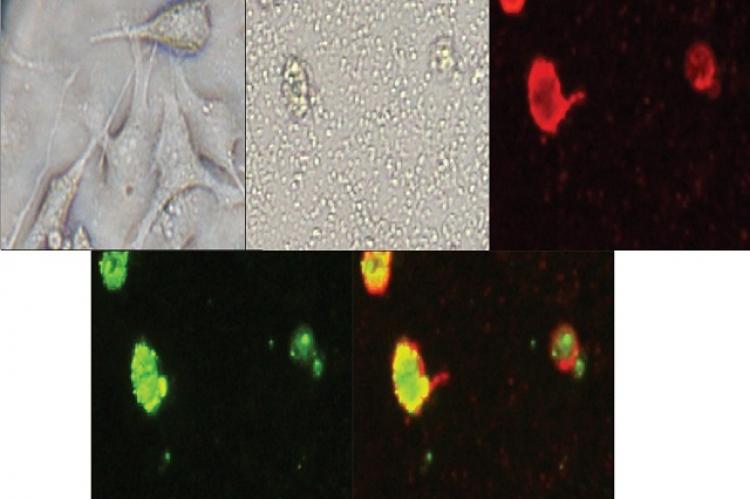 Photomicrograph of MDA-MB-231 cell lines stained with annexin-V substrate after 6 h treatment with 20 μg/mL of ethylacetate extract from G. asiatica roots