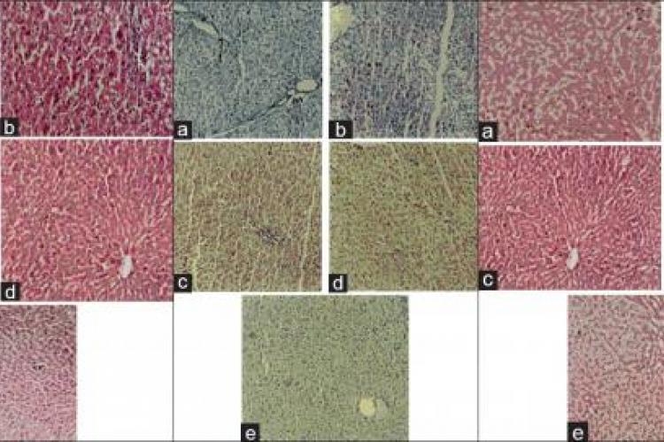 Histopathology of liver tissues. Histopathological study of paracetamol-induced hepatotoxicity