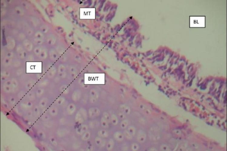 Measurement of the bronchial wall thickness.