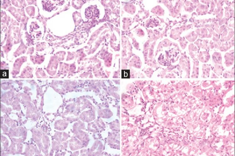 Histopathological observations of spleen, liver, and kidney of mice after subchronic treatment with aqueous extract of Caralluma europaea (H and E stain, ×400)
