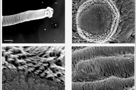 Scanning electron micrographs of an untreated control R. echinobothrida. A. The strobila composed of a series of proglottids with apical scolex (bar = 20 μm). B. A sucker with its marginal rim of rows of spines (bar = 2 μm). C. The finely pointed layers of spines surrounding the sucker (bar = 20 μm). D. Cascades of ciliary microtriches on the tegument of the proglottid (bar = 2 μm).