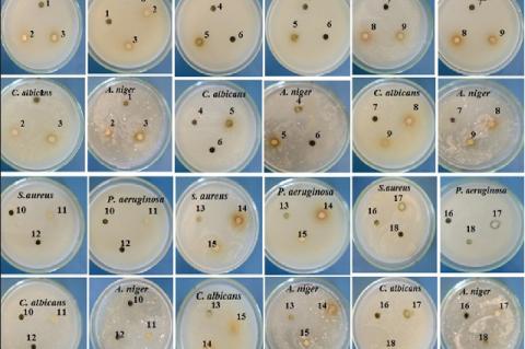 The antimicrobial inhibition zones (mm) of the different solvent extracts from C. nocturnum and C. elegans against four pathogenic microbial strains; Staphylococcus aureus, Pseudomonas aeruginosa, Candida albicans and Aspergillus niger. 1‑Cn‑L (EtOAc), 2‑Cn‑L (H2O), 3‑Cn‑L (n‑BuOH), 4‑Cn‑L (Petroleum ether), 5‑Cn‑L (MeOH), 6‑Cn‑L (CH2Cl2), 7‑Ce‑L (EtOAc), 8‑Ce‑L (H2O), 9‑Ce‑L (n‑BuOH), 10‑Ce‑L (Petroleum ether), 11‑Ce‑L (MeOH), 12‑Ce‑L (CH2Cl2), 13‑Ce‑F (EtOAc), 14‑Ce‑F (H2O), 15‑Ce‑F (n‑BuOH), 16‑Ce‑F (Pet