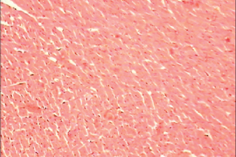 Histopathology of cardiac cells: Normal heart