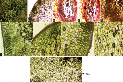 Morphology of aerial parts of Euphorbia trirucalli